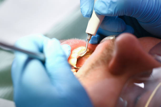 Best Broken or Chipped Tooth Repair in Shelton, CT
